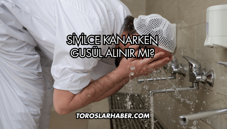 Sivilce Kanarken Gusül Alınır Mı?