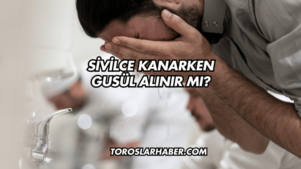 Sivilce Kanarken Gusül Alınır Mı?