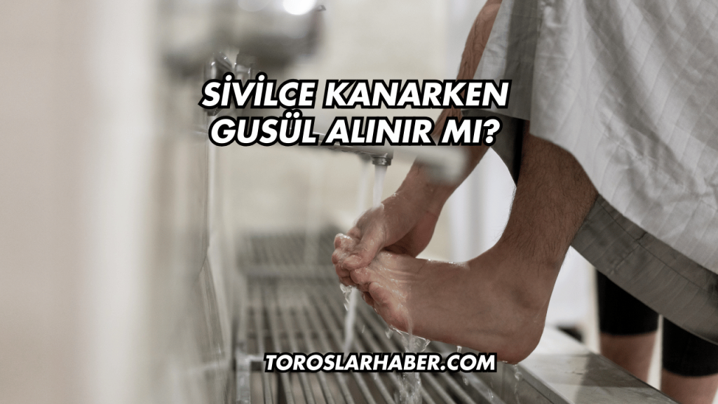 Sivilce Kanarken Gusül Alınır Mı?