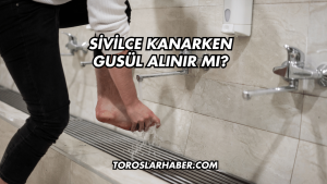Sivilce Kanarken Gusül Alınır Mı?